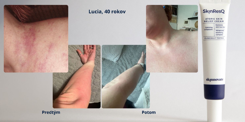 Lucia (40 rokov)